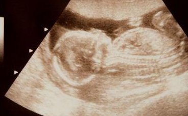 南京鼓楼医院生殖中心开展了哪些诊断项目江苏南京有哪些做试管好的医院